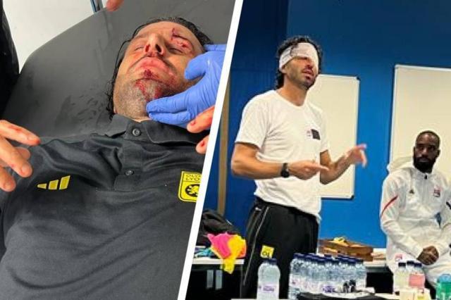 开云体育平台-格罗索遇袭受伤，法甲“意大利德比”被迫延期